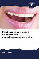 Sukh Sagar | Reabilitaciq Wsego Polosti Rta - Atrofirowannye Zuby | Taschenbuch