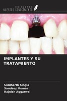 Siddharth Singla (U. A.) | Implantes Y Su Tratamiento | Taschenbuch | Spanisch