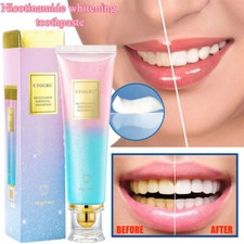 Niacinamide Whitening Toothpaste,Natural Niacinamide Toothpaste,Teeth Whitening