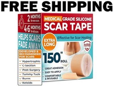 Medical Grade Silicone Scar Tape - 1.6 x150 - Visible Difference on Keloid ...
