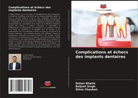 Rohan Bhatia (U. A.) | Complications Et éChecs Des Implants Dentaires | Buch