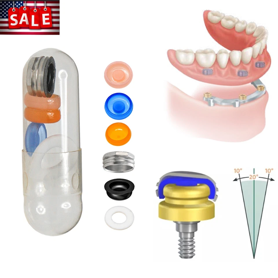 Insertos de tapa masculina localizador de retención de implantes de pilar de sobredentadura dental 20 un. Foto 2 de 4