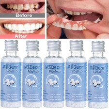 Rubber False Teeth Glue Temporary Tooth Gap Filler Material Fake Teeth Maker