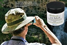 Varicose Vein Cream Vein Care Fading Cream Vein Cream Spider Veins Scars Soothe