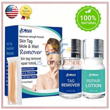 Skin Tag Remover Home Use, Removal of Common Warts, SkinTags Easy to Use 5ML