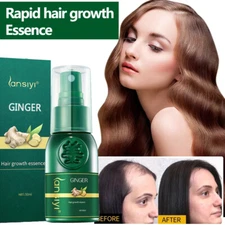 Hair Growth Dense Regrowth Ginger Serum Oil Anti-Loss Treatment Essence Spray