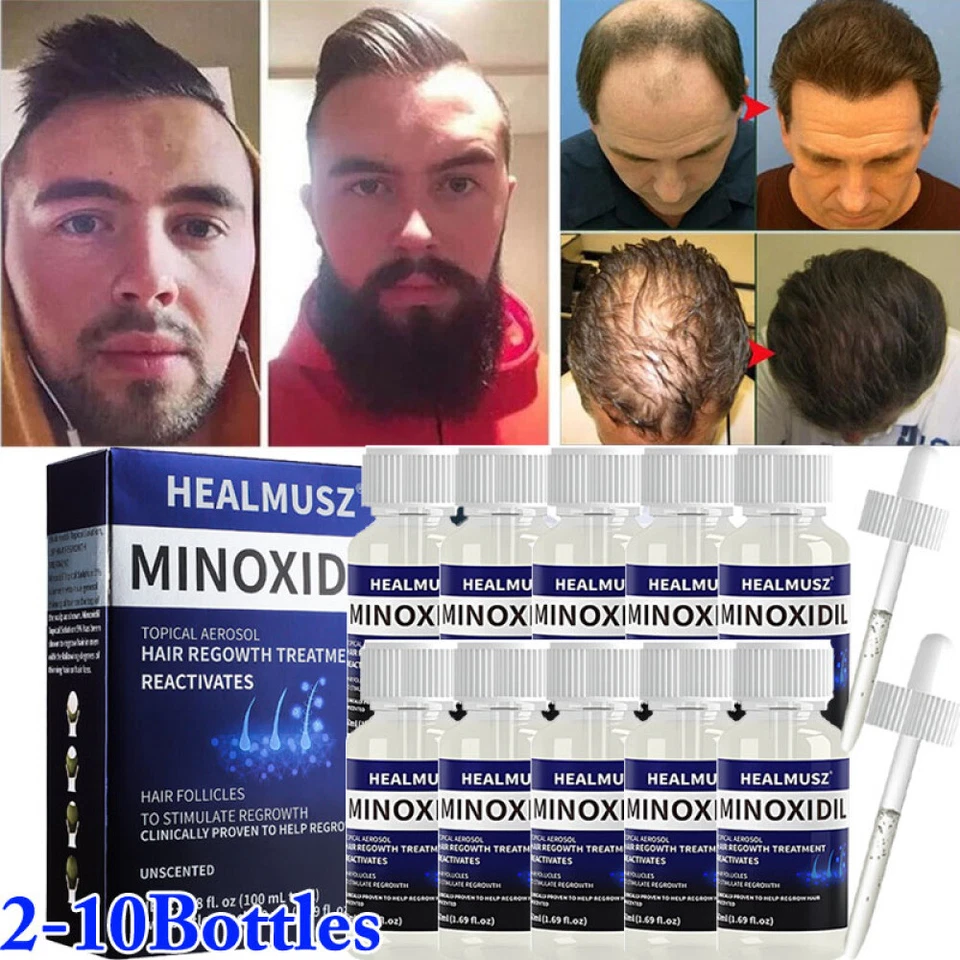 HEALMUSZ Minoxidil 5% Extra Strength For Men Hair Regrowth Treatment 2-10 Month Supply UK