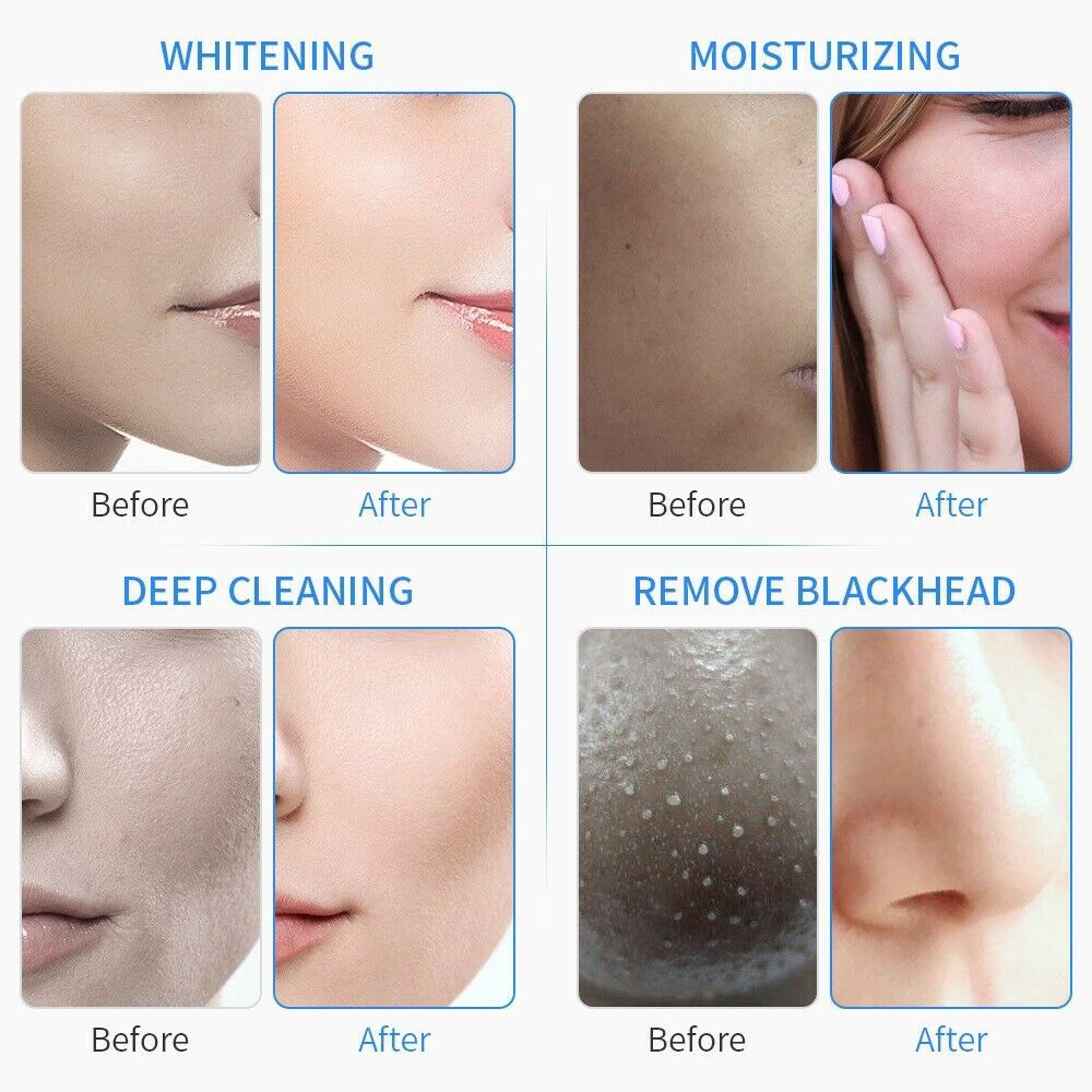 6/7 in 1 Hydra Water Facial Skin Cleaning Hydro Dermabrasion Oxygen Peel Machine