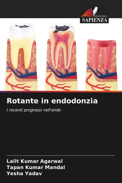 Lalit Kumar Agarwal (U. A.) | Rotante In Endodonzia | Taschenbuch | Italienisch-image