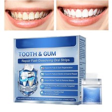 Glimmerly Tooth & Gum Repair Fast-Dissolving Oral Strips,Natural Dental Veneers