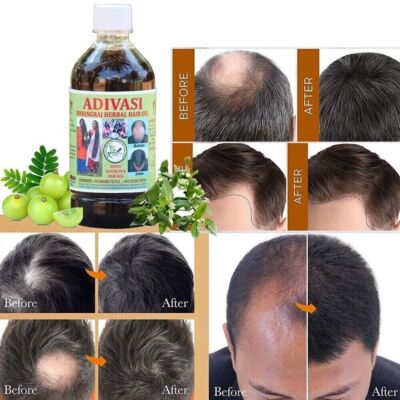 Lot De 2 Huiles Capillaires Ayurvédiques ADIVASI BHRINGRAJ 100ml - 100% Naturelle, Pour La Pousse Et La Réparation