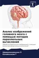 Analiz Izobrazhenij Golownogo Mozga S Pomosch'ü Metodow Parallel'nyh Wychislenij