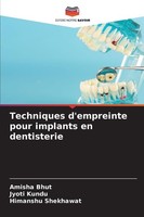 Techniques D'empreinte Pour Implants En Dentisterie Himanshu Shekhawat