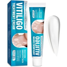 Vitiligo Cream for White Spots on Face or Bod...
