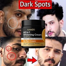Whitening Face Cream for Men - SPF 30  with Kojic Acid  Vitamin C
