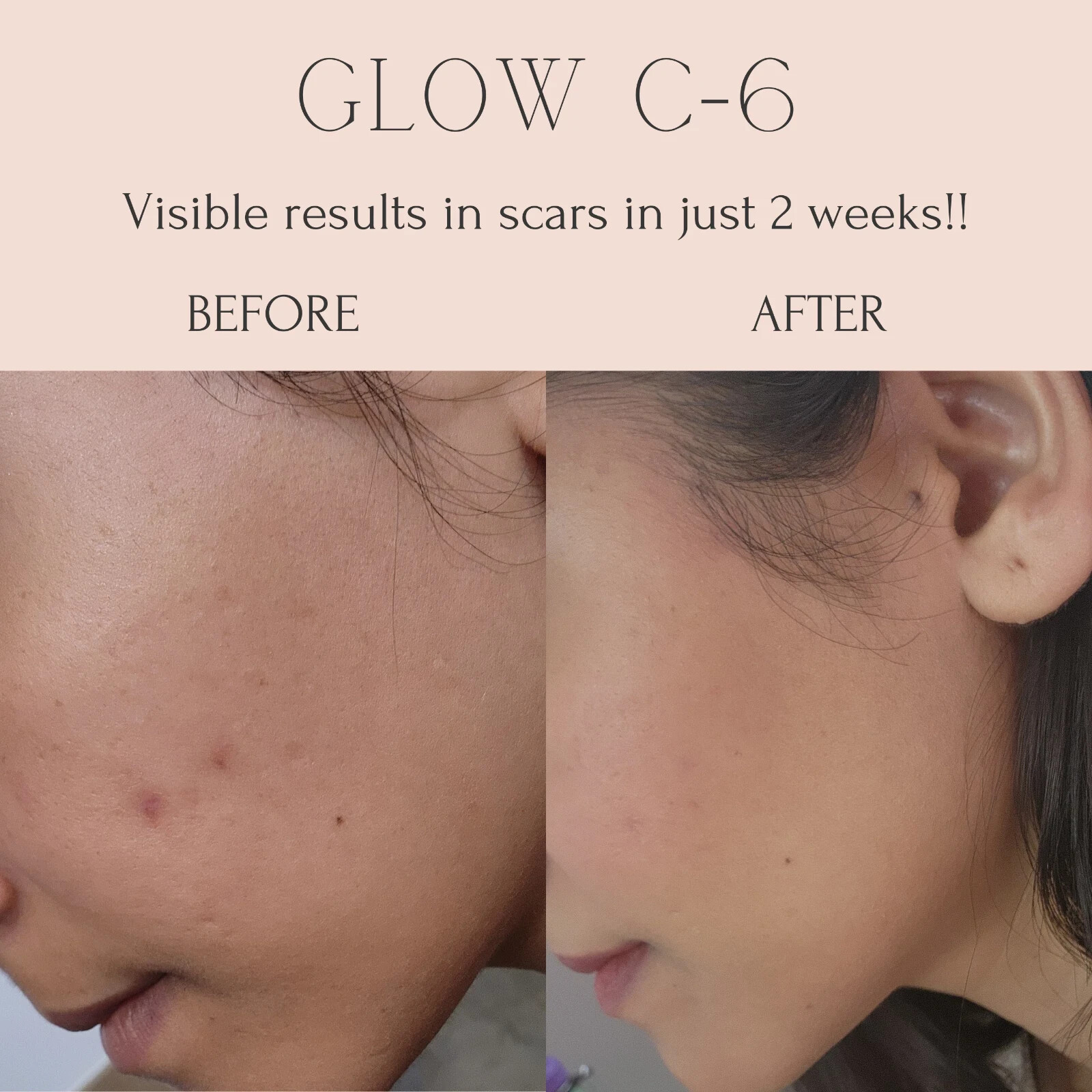 Glow C-6 Vitamin C Serum with Alpha Arbutin, Ferulic Acid, and Guava 1 oz.