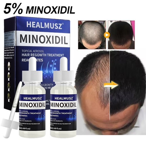 4xExtra Strength Hair Loss&Regrowth Scalp Serum Treatment for Men 4 Month Supply - Picture 6 of 21