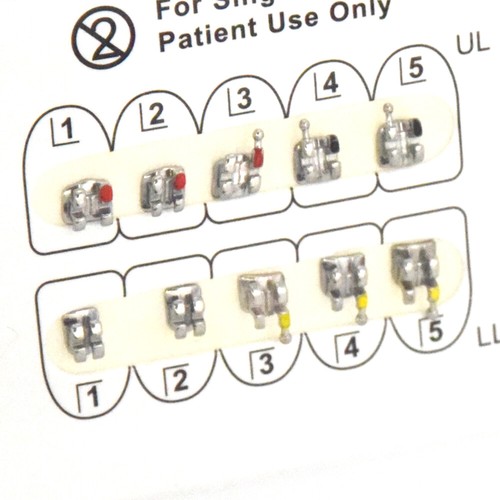 Dental Bracket Ultradünner Monoblock MIM Edgewise ROTH MBT 022 018 345 Haken - Bild 33 von 48