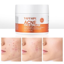 YAFUSIPE Acne Treatment for Face Hormonal Cys...