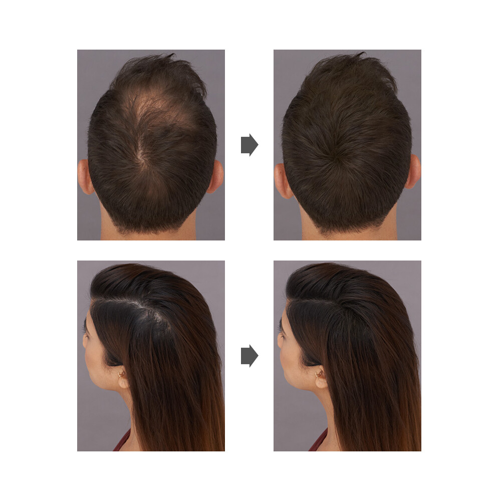 Acquista 3 E Ricevi 2 Gratis🔥Maschera Per Capelli Lussuosa Con Condi - Foto 8