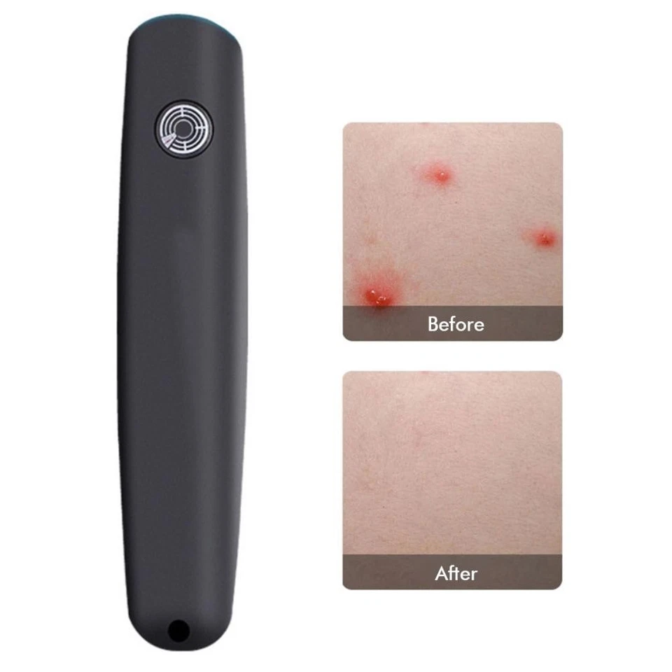 Insect Sting And Bite Relief Pen Mosquito Bug Bite Itch Relief Anti Itch Pe OU - Image 2 of 4