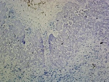 Legume Root Nodule; Section Showing Nitrogen Fixing Bacteria in the Nodules