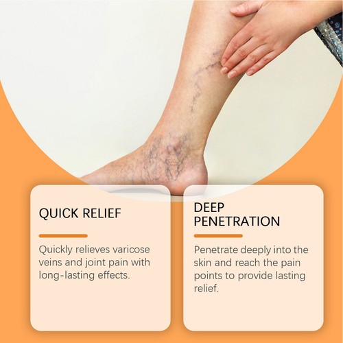 Turmeric Varicose Veins Care Patch , Legs Spider Vein Removal Treatment Patch - Picture 10 of 12