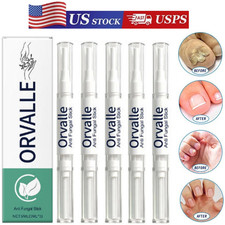 Nail Fungus Pen Anti Fungus Infection Nail Care Repair Pen Toenail