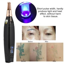 9 Level Laser Beauty Machine Freckle Acne Mole Dark Spot Pigment Removal Pen USA