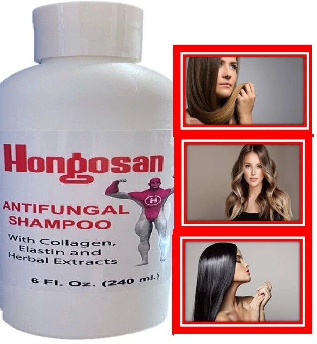 Shampoo hair druff antifungal Caspa Anticaspa Champu Psoriasis Cabello