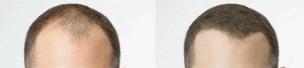 Recarga de fibra capilar para botellas nanogen 57 g LLENA 2 BOTELLAS Envío gratuito Foto 4 de 4