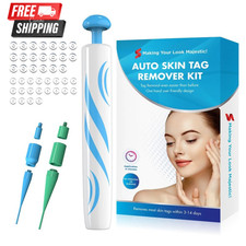 Auto Micro Skin Tag Remover Device Kit Safe Painless Removal 2-8 mm Band Tool