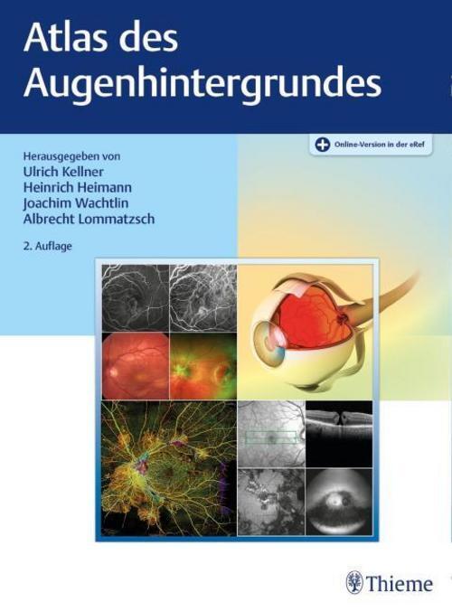 Thumbnail - Atlas Des Augenhintergrundes Ulrich Kellner