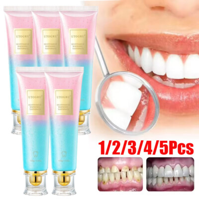Enhanced 1-5X Niacinamide Whitening Toothpaste Niacinamide Intensive Whitening T