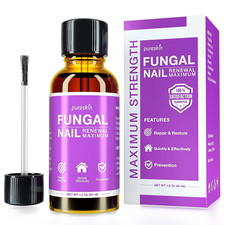 Toenail Fungus Treatment Extra Strength: Nail Fungus Treatment Fortoenails and F