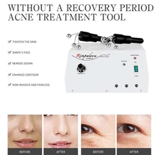 Microcurrent Facial Roller Lifting Tightening Anti-Wrinkle Beauty Instrument