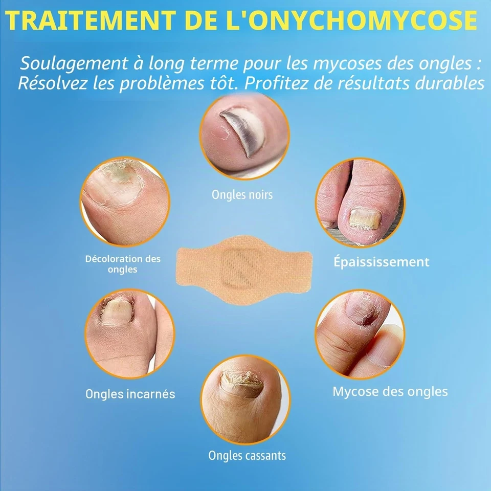 Patchs antifongiques ongles pieds 32 pièces soin mycose hydrogel nuit - Photo 4/4