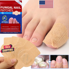 21pcs/box Fungal Nail Care Patches, box 8H Overnight Toenail Repair Care.