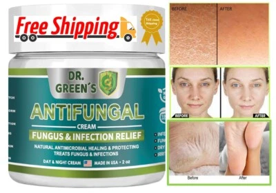DRGREENS ANTIFUNGAL Athlete's foot cream Heels dry cracked foot toenails antifungal