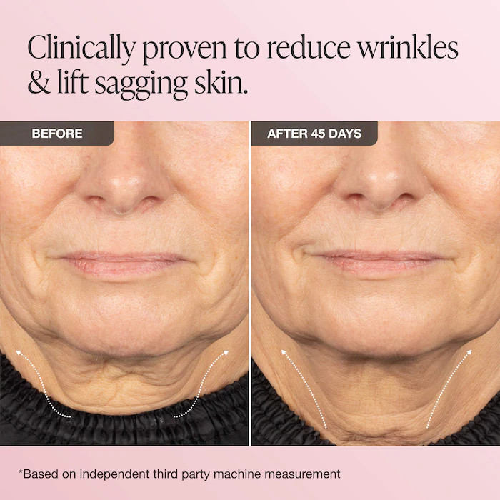 INNBEAUTY Project Extreme Cream Anti-Aging, Firming Lifting Refillable Moisturiz