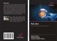 Hugo Esteva (U. A.) | Rak P¿Uc | Taschenbuch | Polnisch (2020)