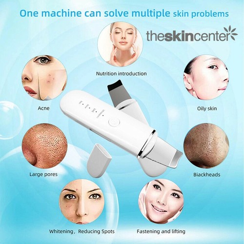Ultrasonic Skin Scrubber - Black Head Remover - Skin Spatula - Picture 5 of 7