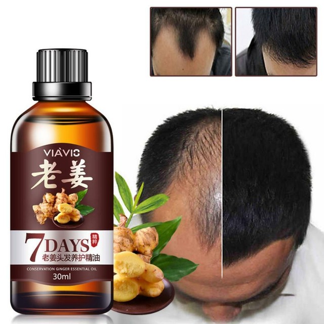 Tratamiento Para La Perdida Del Pelo Aceite Anti Ca da Del Cabello 100 tratamiento-para-la-perdida-del-pelo-aceite-anti-ca-da-del-cabello-100