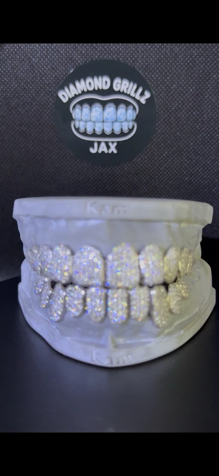 VVS DIAMOND MOISSANITE GRILLZ (PREVENTA) Foto 4 de 4