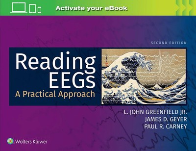James D. Geyer (u. a.) | Reading EEGs: A Practical Approach | Taschenbuch (2020)