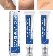 Scar Cream,Scar Removal Cream,Silicone Scar Gel,Scar Silicone Gel,Scar Gel,Scar