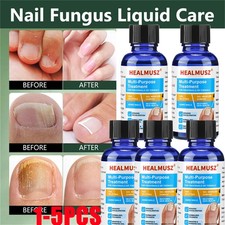 Nail Fungus Treatment Serum Foot Repair Liquid Toe Nails Fungal Removal Nails