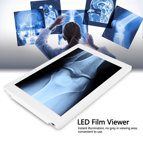 EU Plug AC 100240V LED XRay Viewer Illumination With High Brightness 36cmx24cm - Picture 6 of 12