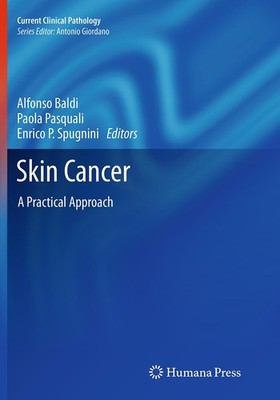Skin Cancer Alfonso Baldi