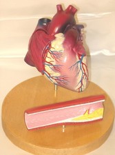 Heart anatomical model anatomy medical display arterial plaque disease New